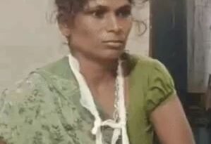कुत्ते ने मासूम पर किया हमला, मां ने अपनी जान की परवाह किए बिना बचाया बेटा