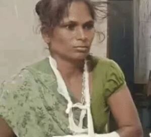 कुत्ते ने मासूम पर किया हमला, मां ने अपनी जान की परवाह किए बिना बचाया बेटा